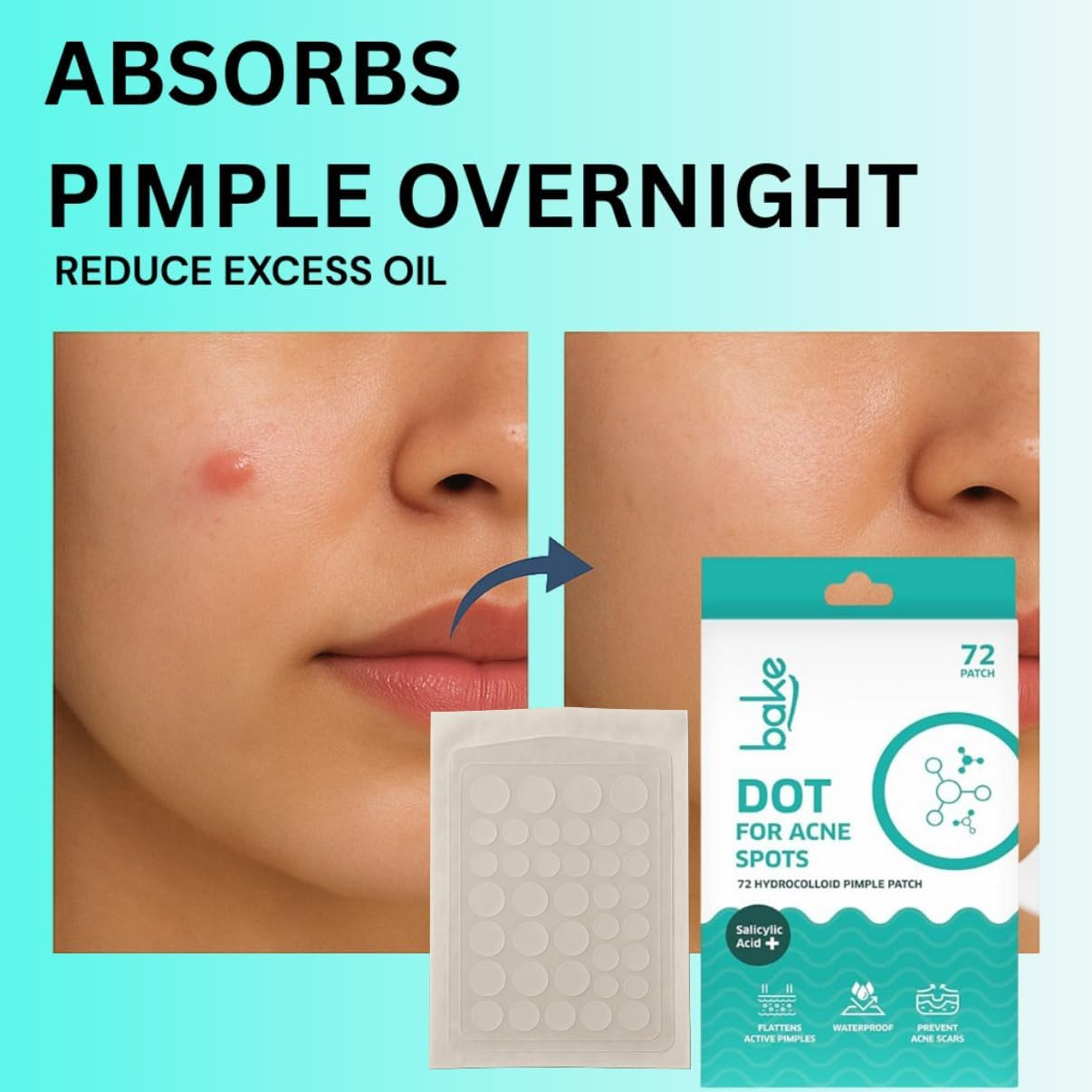 BAKE 2% Salicylic Acid Pimple Patches for Active Acne (72 Dots) | with Hydrocolloid Waterproof Patches | for Acne Marks, Acne Prone Skin | for All Skin Types (Pack of 72) image number 2