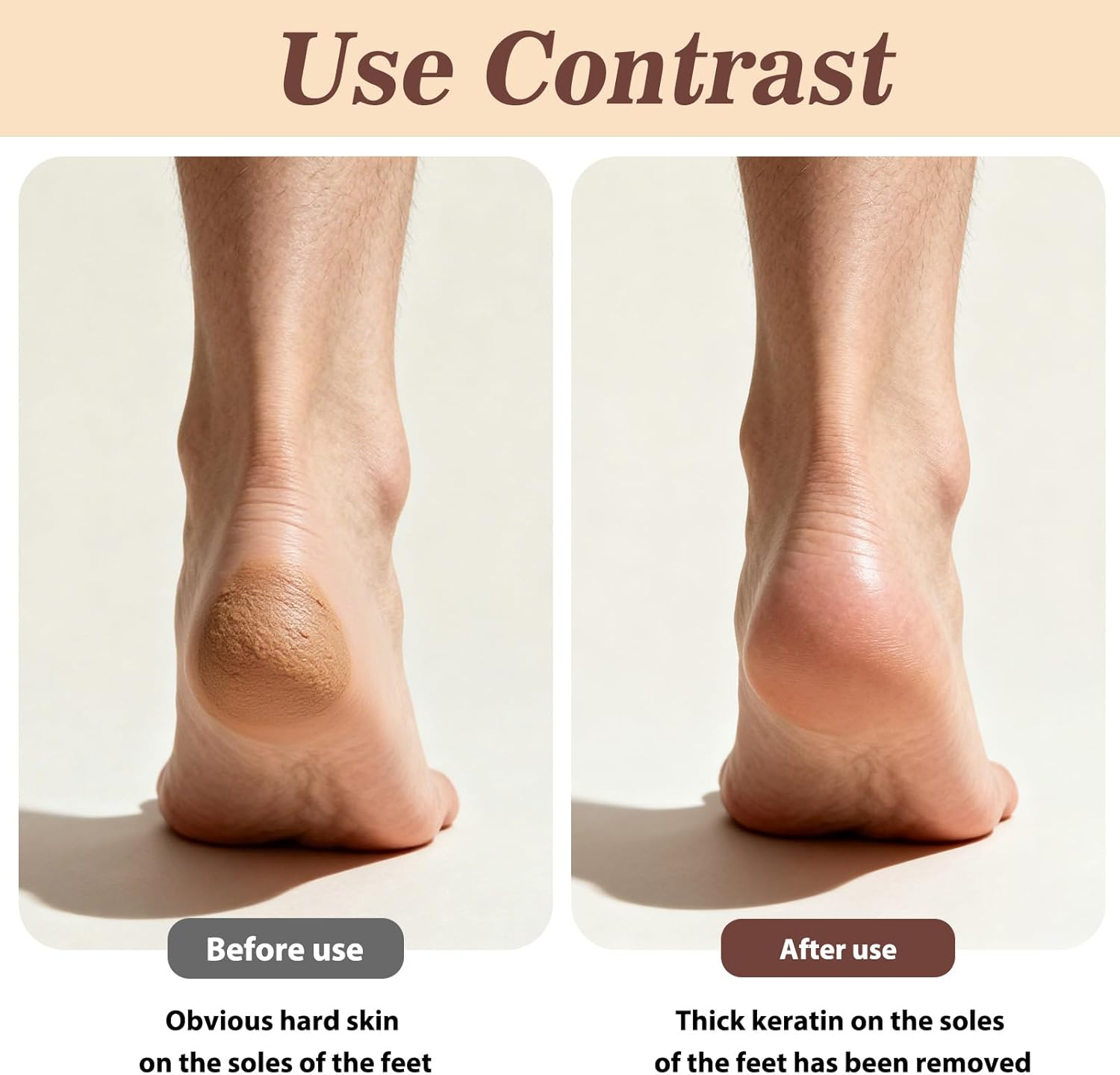 Stainless Steel Foot File and Callus Remover - Comes with Storage Box for Hard Skin Removal on Cracked Heels, Wet & Dry Pedicure Use - Black image number 4